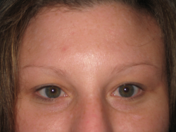  Before Picture (eyebrows)