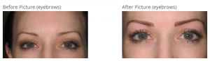 before-and-after-permanent-eyebrows